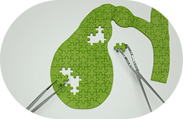 Cirurgia das Vias Biliares