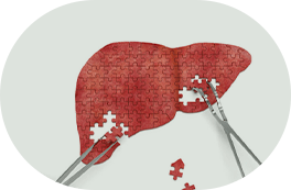 Cirurgia do Fígado
