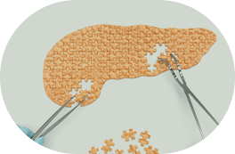 Cirurgia do Pâncreas