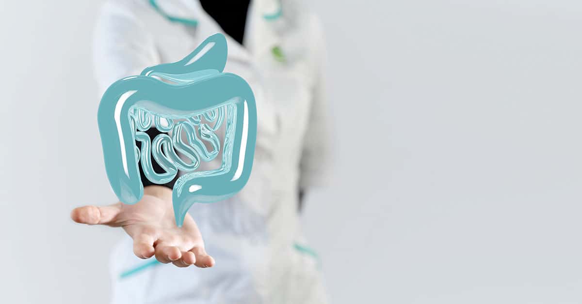 Ilustração de cirurgia minimamente invasiva do intestino