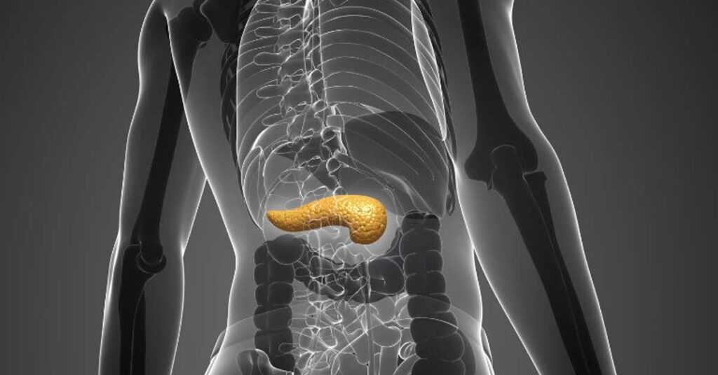 Quais os riscos de uma Cirurgia do Pâncreas Informações cruciais